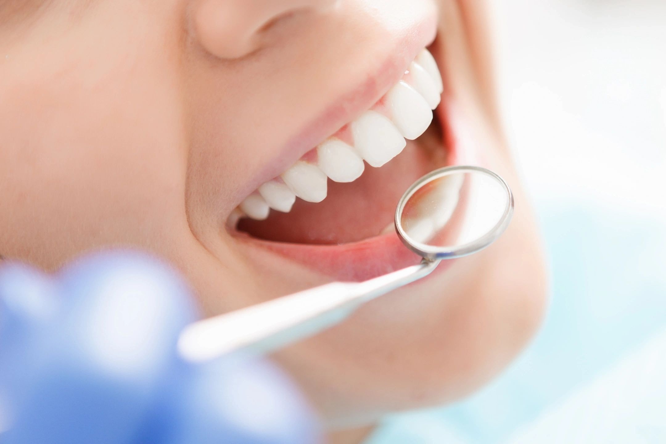 Close-up dental examination showing white teeth